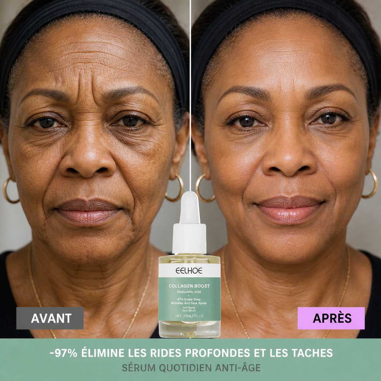 EELHOE Collagen Boost — Efface les Rides en 7 Jours